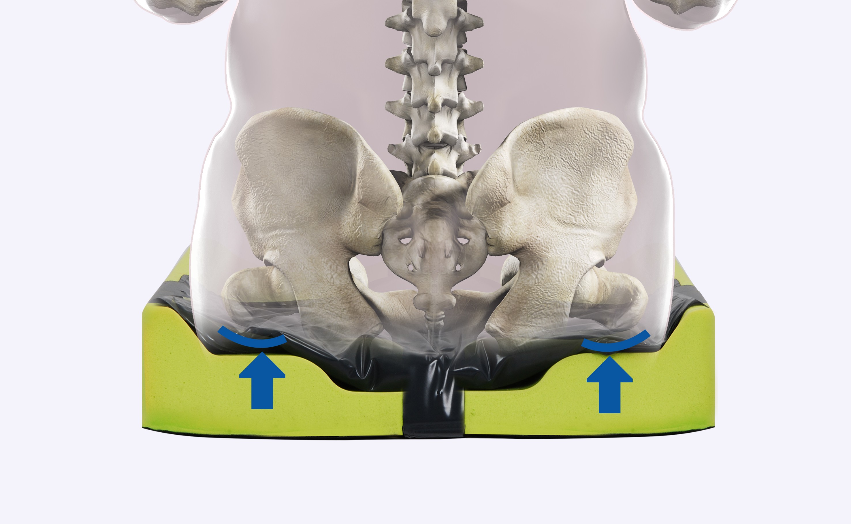 Pressure Redistribution